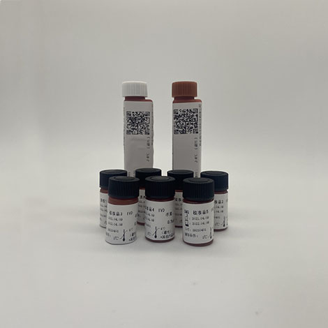 β2-微球蛋白（BMG）检测试剂盒（胶乳免疫比浊法）